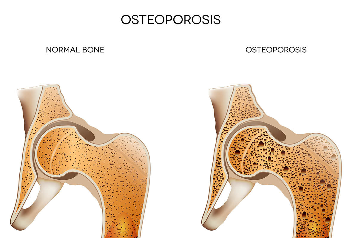 Resistance Training Part 3